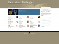 illustrationmedicale.blog.free.fr Thumbnail