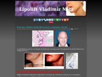 lipolift-vladimir-mitz.com Thumbnail