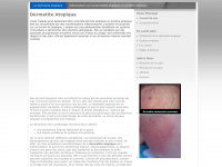 Eczema-atopique.net