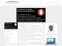 E-cardiogram.com